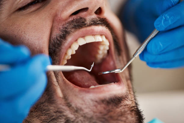 Best Teeth Whitening  in Lander, WY